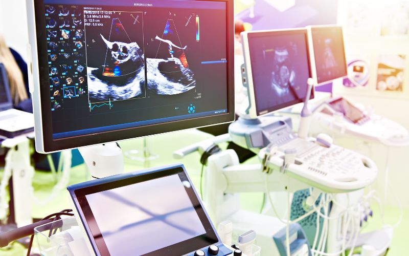 Nhiều bệnh viện lớn trong cả nước đang tuyển dụng bác sĩ siêu âm