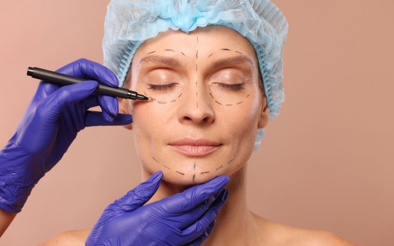 Việc hành nghề phẫu thuật thẩm mỹ được nhà nước quản lý chặt chẽ